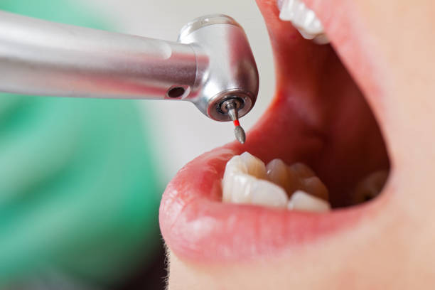 Best Emergency Dentist for Knocked-Out Tooth in Jennerstown, PA